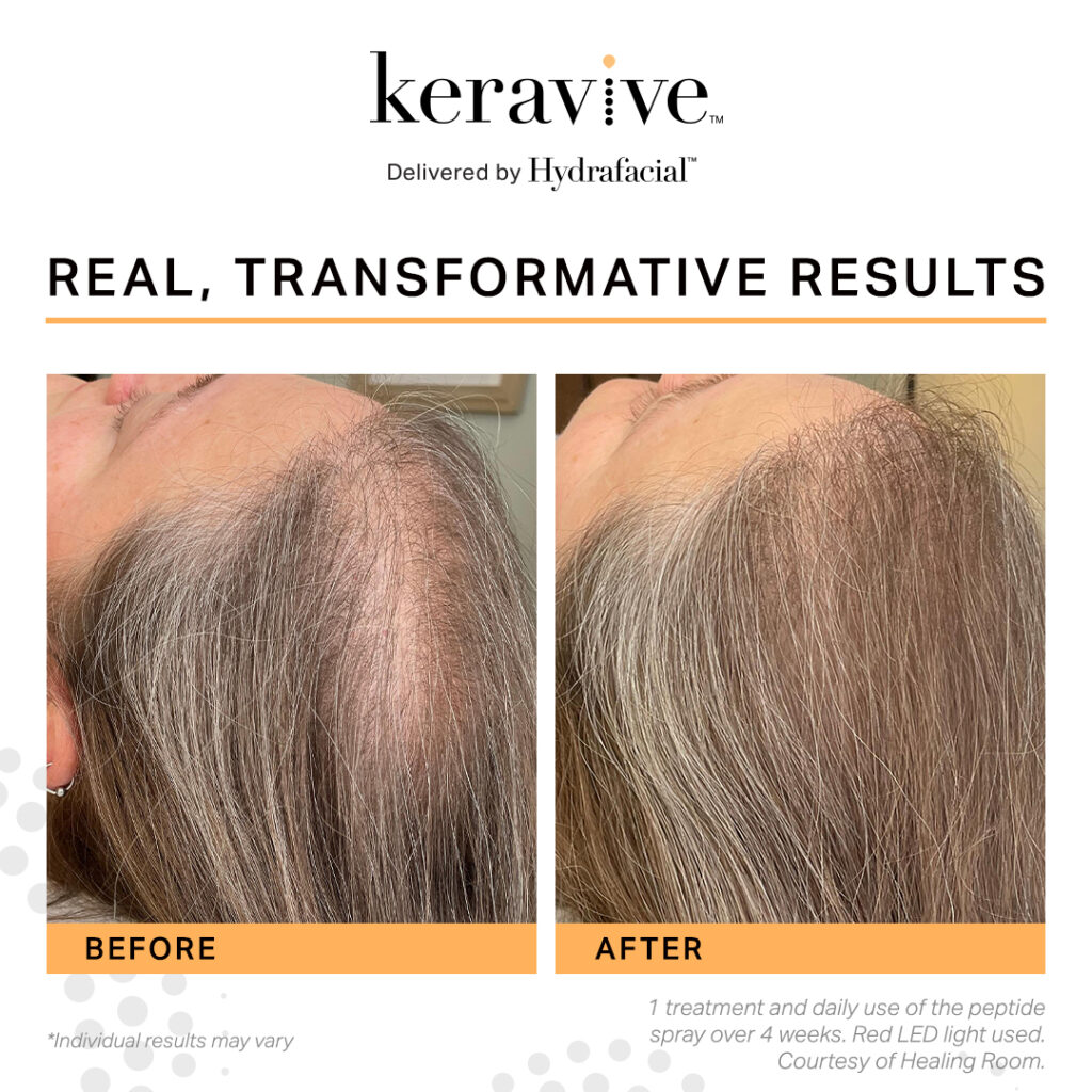 Keravive-SocialPosts-6