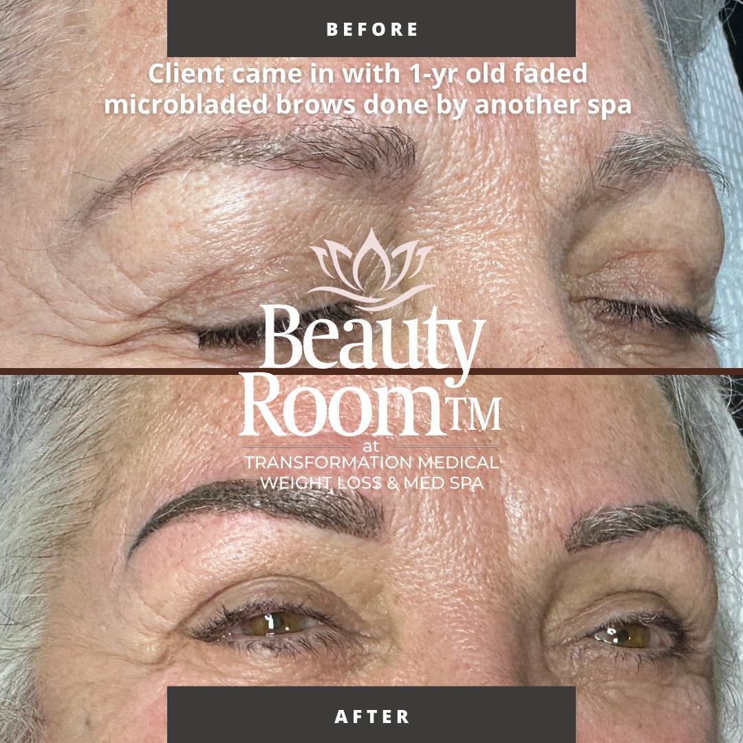 Before and After Image: NanoBrows - front