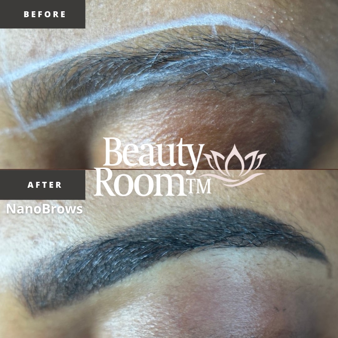 Before and After Image: NanoBrows - front