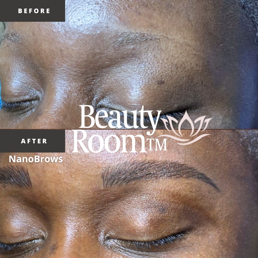 Before and After Image: NanoBrows - front