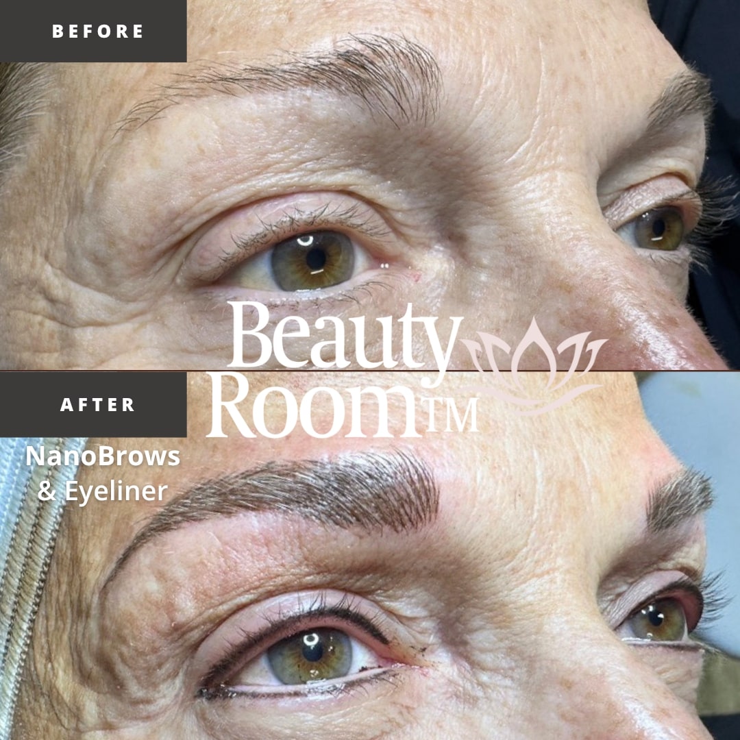 Before and After Image: NanoBrows - front