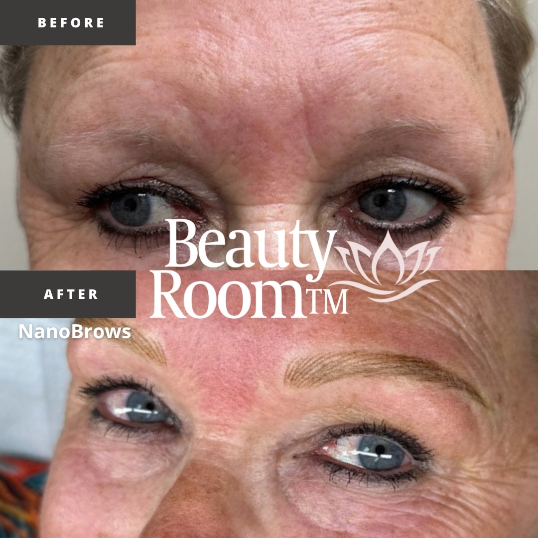 Before and After Image: NanoBrows - front