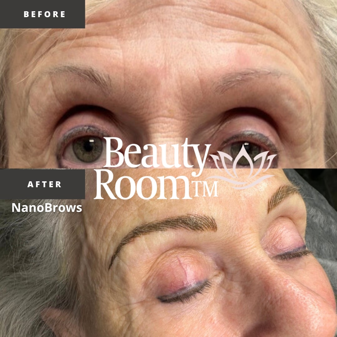 Before and After Image: NanoBrows - front