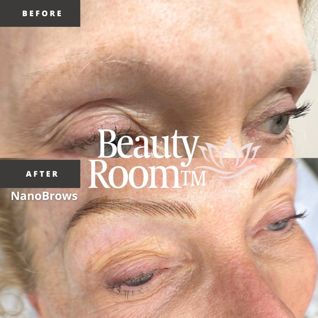 Before and After Image: NanoBrows - front