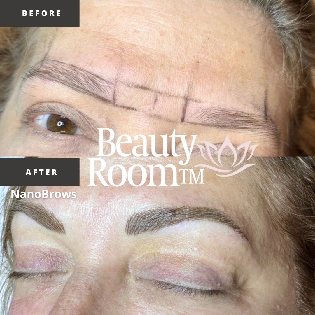 Before and After Image: NanoBrows - front