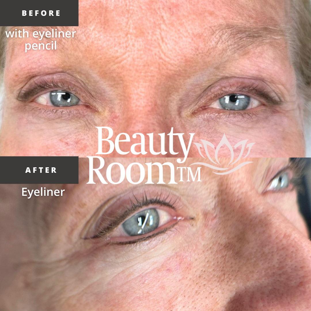 Before and After Image: Eyeliner - front